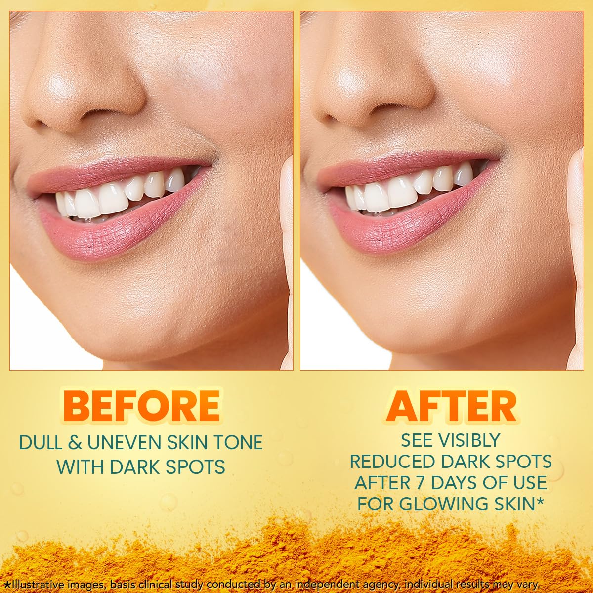 Himalaya Dark Spot Clearing Turmeric Face Serum, 15 mL | with 10% Glycolic Acid, 2% Niacinamide & Organically sourced Turmeric | Visibly Reduces Dark Spots from Day 7 | Clinically Tested | Non Staining